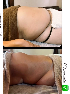 Priscilaから提供された腹部ケアの比較写真